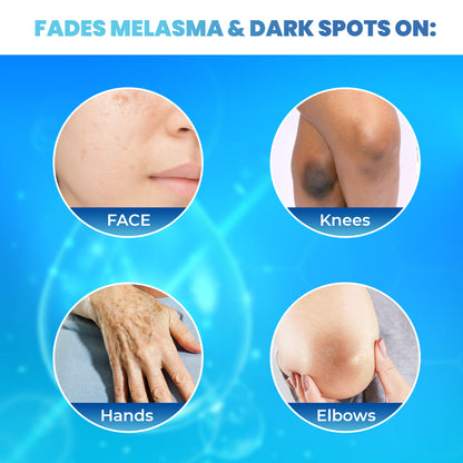 Fair &amp; White Glutathion Extra Anti-Dark Spot Serum 30ml