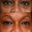 Clear Essence LEMON Plus Vit-C Perfecting Under Eye Fade Serum 0.5oz / 15ml Clear Essance