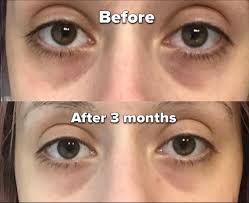 Clear Essence Platinum Skin Lightening under eye Serum 0.5oz / 15ml Clear Essance