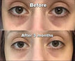 Clear Essence LEMON Plus Vit-C Perfecting Under Eye Fade Serum 0.5oz / 15ml Clear Essance
