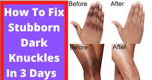 Carotone DSP10 Tube Cream 1 oz / 30 ml carotone