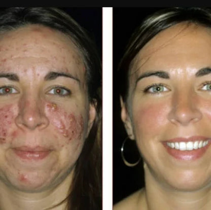 Miss U Nano Kojic Papaya 