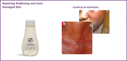 Mekako S.O.S. 15 Plus Active Oil 5.07 oz / 150 ml mekako