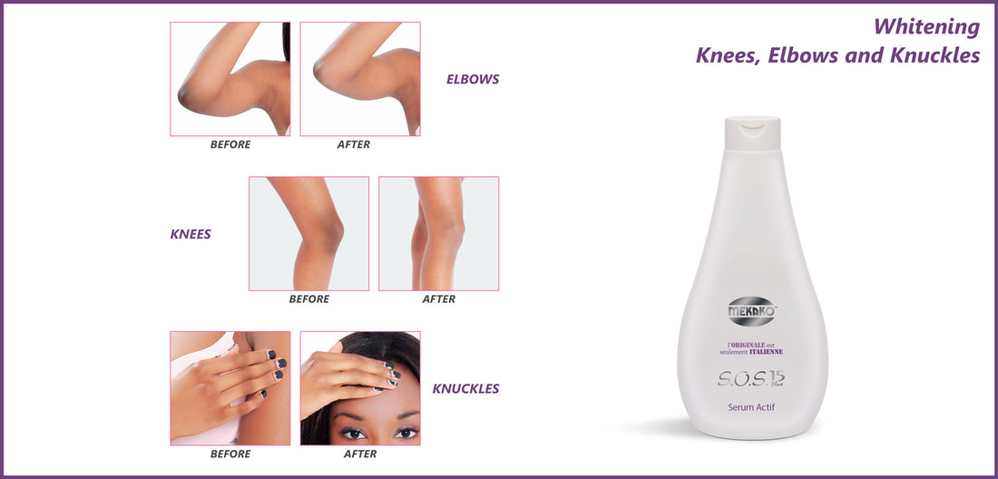 Mekako S.O.S. 15 Plus Active Oil 5.07 oz / 150 ml mekako