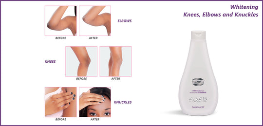 Mekako S.O.S. 15 Plus Active Oil 5.07 oz / 150 ml mekako